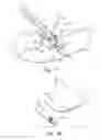 Fig. 12 - Deployment device for a soft tissue repair prosthesis