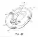 Fig. 28 - Deployment device for a soft tissue repair prosthesis