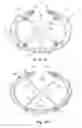Fig. 06 - Prothesis for repairing a hernia defect