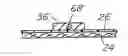 Fig. 01 - Prosthesis for repairing a hernia defect