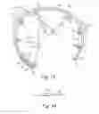 Fig. 08 - Prosthesis for repairing a hernia defect