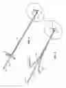 Fig. 04 - Multi-access intraprocedural embolic protection device