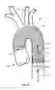 Fig. 23 - Multi-access intraprocedural embolic protection device