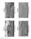 Fig. 03 - Devices and methods for endothelialization of magnetic vascular grafts