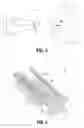 Fig. 03 - Prosthetic implant delivery device and method