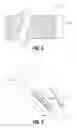 Fig. 04 - Prosthetic implant delivery device and method