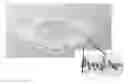 Fig. 01 - CARDIAC PROSTHESIS STABILIZATION SYSTEM
