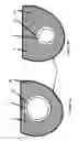 Fig. 04 - CARDIAC PROSTHESIS STABILIZATION SYSTEM
