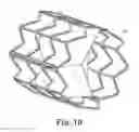 Fig. 06 - Delivery systems and methods of implantation for prosthetic heart valves