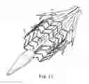 Fig. 11 - Delivery systems and methods of implantation for prosthetic heart valves
