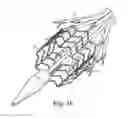 Fig. 12 - Delivery systems and methods of implantation for prosthetic heart valves