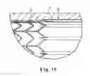 Fig. 14 - Delivery systems and methods of implantation for prosthetic heart valves