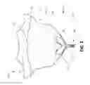 Fig. 07 - Thrombus management and structural compliance features for prosthetic heart valves