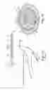 Fig. 02 - Method of implanting a penile prosthetic with a tool having movable jaws