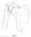 Fig. 06 - Multi-component implant assembly with dual articulating and/or rotating surfaces