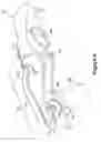 Fig. 05 - Bidirectional biomechanical prosthetic full finger configured for abduction and adduction with MCP pivot and multiple-finger ring