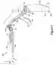 Fig. 08 - Bidirectional biomechanical prosthetic full finger configured for abduction and adduction with MCP pivot and multiple-finger ring