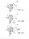Fig. 10 - Prosthetic device, system and method for increasing vacuum attachment