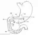 Fig. 01 - Method and apparatus for reducing obesity