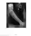 Fig. 02 - Compliant elbow brace configurations
