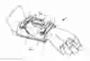 Fig. 01 - Orthopaedic device and method of use for treating bone fractures