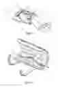 Fig. 02 - Orthopaedic device and method of use for treating bone fractures