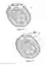 Fig. 09 - Orthopaedic device and method of use for treating bone fractures