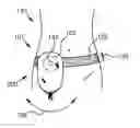 Fig. 01 - Ostomy pouch support kit, system and method