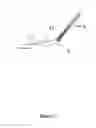 Fig. 09 - Ophthalmic knife and methods of use