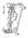 Fig. 140 - Patient positioning support apparatus with virtual pivot-shift pelvic pads, upper body stabilization and fail-safe table attachment mechanism