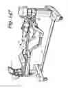 Fig. 141 - Patient positioning support apparatus with virtual pivot-shift pelvic pads, upper body stabilization and fail-safe table attachment mechanism