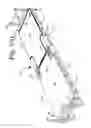 Fig. 164 - Patient positioning support apparatus with virtual pivot-shift pelvic pads, upper body stabilization and fail-safe table attachment mechanism