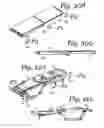 Fig. 194 - Patient positioning support apparatus with virtual pivot-shift pelvic pads, upper body stabilization and fail-safe table attachment mechanism