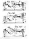 Fig. 203 - Patient positioning support apparatus with virtual pivot-shift pelvic pads, upper body stabilization and fail-safe table attachment mechanism