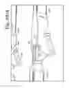 Fig. 250 - Patient positioning support apparatus with virtual pivot-shift pelvic pads, upper body stabilization and fail-safe table attachment mechanism