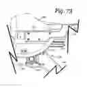 Fig. 73 - Patient positioning support apparatus with virtual pivot-shift pelvic pads, upper body stabilization and fail-safe table attachment mechanism