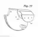 Fig. 77 - Patient positioning support apparatus with virtual pivot-shift pelvic pads, upper body stabilization and fail-safe table attachment mechanism