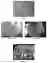 Fig. 02 - Enalapril compositions