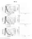 Fig. 17 - Microfluidic liposome synthesis, purification and active drug loading