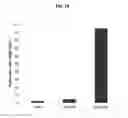 Fig. 22 - Microfluidic liposome synthesis, purification and active drug loading