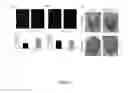 Fig. 04 - Small molecule inhibitors targeting CAG-repeat RNA toxicity in polyglutamine diseases