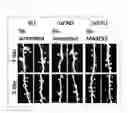 Fig. 14 - Diagnosis methods, diagnostic agents, and therapeutic agents against alzheimer's disease and frontotemporal lobar degeneration, and screening methods for these agents