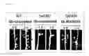 Fig. 18 - Diagnosis methods, diagnostic agents, and therapeutic agents against alzheimer's disease and frontotemporal lobar degeneration, and screening methods for these agents