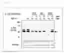 Fig. 21 - Diagnosis methods, diagnostic agents, and therapeutic agents against alzheimer's disease and frontotemporal lobar degeneration, and screening methods for these agents
