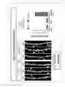 Fig. 30 - Diagnosis methods, diagnostic agents, and therapeutic agents against alzheimer's disease and frontotemporal lobar degeneration, and screening methods for these agents