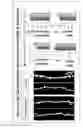 Fig. 32 - Diagnosis methods, diagnostic agents, and therapeutic agents against alzheimer's disease and frontotemporal lobar degeneration, and screening methods for these agents