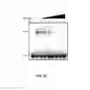 Fig. 07 - Materials and method for inhibiting replication protein A and uses thereof