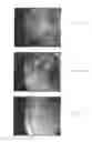 Fig. 02 - Materials and methods for treatment and diagnosis of disorders associated with oxidative stress