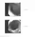 Fig. 03 - Materials and methods for treatment and diagnosis of disorders associated with oxidative stress