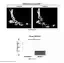 Fig. 07 - Method of treating heterotopic ossification